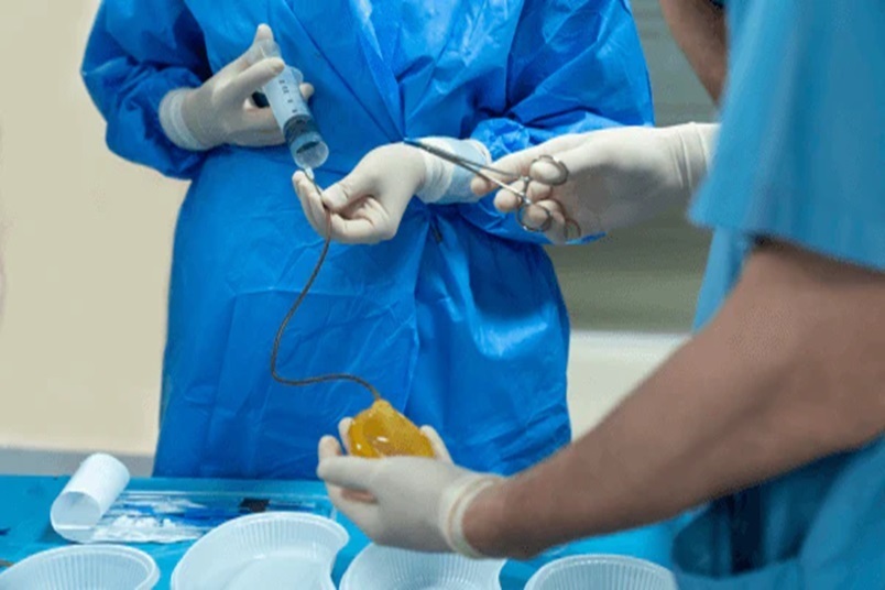 Procedure of Penile Implant Surgery - AndroNeo Hospital